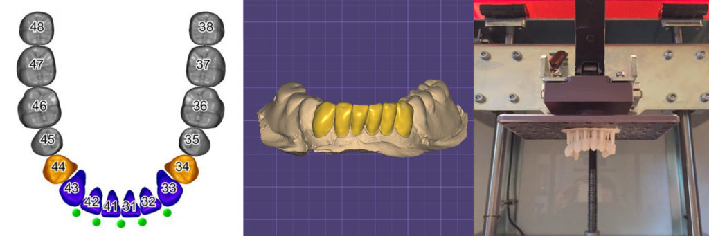 Odontotecnici 3D