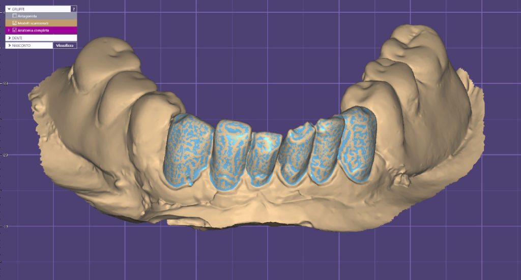 Odontotecnici 3D