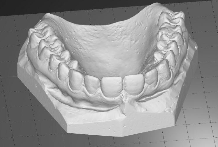 Realizzare Modelli per Ortodonzia